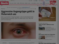Bild zum Artikel: Warnung: Aggressive Augengrippe geht in Österreich um