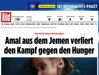 Bild zum Artikel: Ihr Foto ging um die Welt - Amal aus dem Jemen verliert den Kampf gegen den Hunger