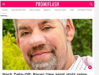 Bild zum Artikel: Nach Zahn-OP: Bauer Uwe zeigt stolz seine neuen Zähne!