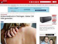 Bild zum Artikel: Schmalkalden - Krätze bricht in Thüringen aus - mehr als 60 Fälle gemeldet