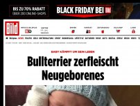 Bild zum Artikel: Baby kämpft um sein Leben - Bullterrier zerfleischt Neugeborenes