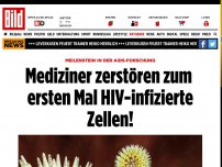 Bild zum Artikel: Meilenstein in Aids-Forschung - Mediziner zerstören zum ersten Mal HIV-infizierte Zellen!