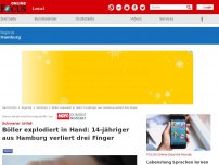 Bild zum Artikel: Hamburg - Schwerer Unfall in Alsterdorf: Böller explodiert in Hand! 14-Jähriger verliert Finger