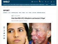Bild zum Artikel: Dieb überfällt UFC-Kämpferin und kassiert Prügel