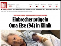 Bild zum Artikel: Ring vom Finger gerissen - Einbrecher prügeln Oma Else (94) in Klinik