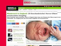 Bild zum Artikel: 28 Knochenbrüche! Horror-Eltern misshandeln Säugling