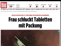 Bild zum Artikel: Ärzte rätselten 17 Tage - Frau schluckt Tabletten mit Packung