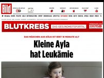 Bild zum Artikel: Sie ist erst 18 Monate alt - Kleine Ayla hat Leukämie