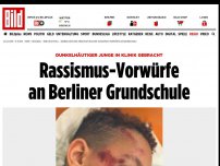 Bild zum Artikel: Junge verletzt - Rassismus-Vorwürfe an Berliner Grundschule