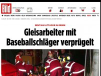 Bild zum Artikel: Brutale Attacke in Essen - Gleisarbeiter mit Baseballschläger verprügelt