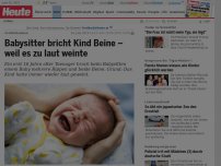 Bild zum Artikel: Babysitter bricht Kind Beine – weil es zu laut weinte