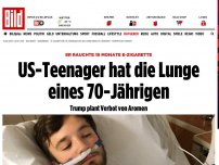 Bild zum Artikel: Nach 1,5 Jahren E-Zigarette - US-Teenager hat die Lunge eines 70-Jährigen