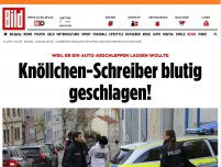 Bild zum Artikel: Wegen Abschlepp-Auftrag - Knöllchen-Schreiber blutig geschlagen!