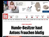 Bild zum Artikel: Streit auf der Hundewiese - Fieser Welpen-Werfer haut Antons Frauchen blutig