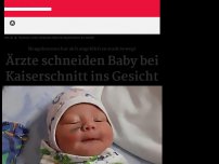 Bild zum Artikel: Im Gesicht verletzt