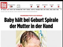 Bild zum Artikel: Bei der Geburt hielt er sie in der Hand - Junge kommt mit Spirale der Mutter zur Welt
