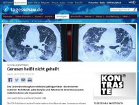 Bild zum Artikel: Corona-Langzeitfolgen: Genesen heißt nicht geheilt