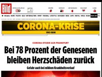 Bild zum Artikel: Corona-Studie aus Frankfurt - Bei 78 Prozent der Genesenen bleiben Herzschäden