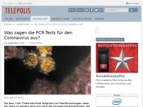 Bild zum Artikel: Was sagen die PCR-Tests für den Coronavirus aus?