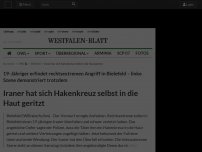 Bild zum Artikel: Bielefeld: Iraner hat sich Hakenkreuz selbst in die Haut geritzt