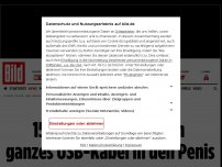 Bild zum Artikel: Not-OP! - 15-Jähriger schiebt ganzes USB-Kabel in den Penis