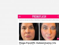 Bild zum Artikel: Mega-Facelift: Katzenmama Iris Klein zeigt ihr neues Gesicht