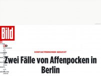 Bild zum Artikel: Kontaktpersonen gesucht - Zwei Fälle von Affenpocken in Berlin