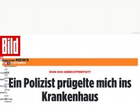 Bild zum Artikel: Mann bei Festnahme schwer verletzt - „Ein Polizist trat mir grundlos ins Gesicht“