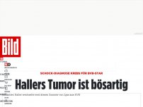 Bild zum Artikel: Schock-Diagnose Krebs für BVB-Star - Hallers Tumor ist bösartig