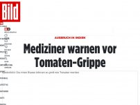 Bild zum Artikel: Ausbruch in Indien - Mediziner warnen vor Tomaten-Grippe