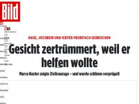 Bild zum Artikel: Nase, Jochbein und Kiefer mehrfach gebrochen - Gesicht zertrümmert, weil er helfen wollte