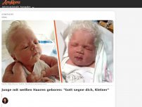 Bild zum Artikel: Junge mit weißen Haaren geboren: 'Gott segne dich, Kleiner'